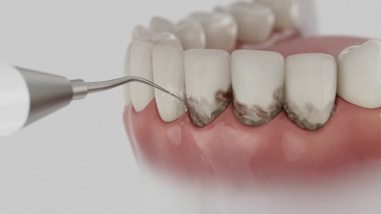 Reliable Emergency Dentist contractor in Georgetown, KY by Smile Center Dentistry